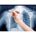 Marqueur Spécial Radiologie 8010 Blanc Pointe Fine 0 8 mm x 10 EDDING